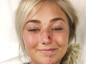 Patah Tulang dan Berdarah, Wanita Ini Masih Sempat Review Pensil Alis