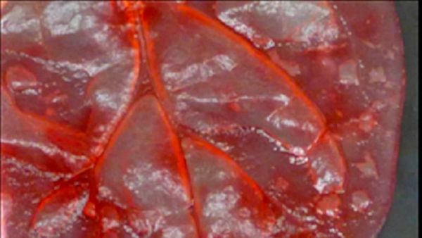 Ketika Daun Bayam Disulap Peneliti Jadi Jantung Manusia