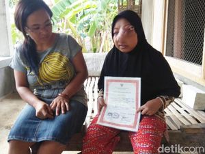 Nelangsa Fitri, Gadis Lamongan yang 17 Tahun Matanya Tertutup Tumor