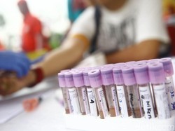 Hari AIDS Sedunia, Kenali Gejala HIV-AIDS pada Wanita
