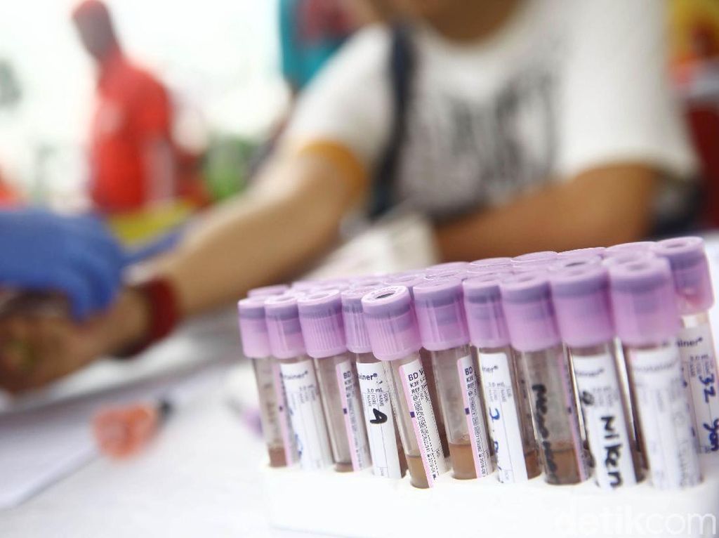 Kenapa Pasien London dan Pasien Berlin Bisa Sembuh dari Infeksi HIV? Kenapa Pasien London dan Pasien Berlin Bisa Sembuh dari Infeksi HIV?