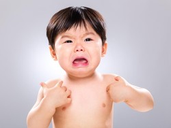 Bintik Merah di Kulit Anak Usai Minum Susu Bisa Jadi Tanda Alergi