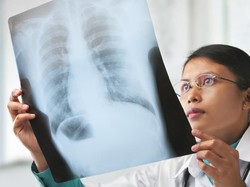 Pneumonia Misterius Gemparkan China, Ini Imbauan Kemenkes RI