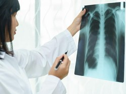 6 Cara Alami Membersihkan Lendir Paru-paru, Bisa Dicoba di Rumah