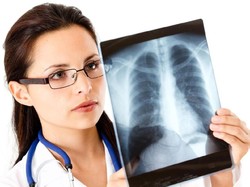 Vape Dikaitkan Juga dengan Lipoid Pneumonia, Paru-paru Tersumbat Lemak