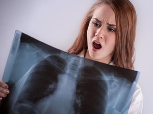 4 Hal yang Tanpa Sadar Bikin Paru-paru Empot