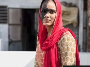 Kisah Sedih Wanita yang Sulit Menikah karena Punya Tanda Lahir di Wajah