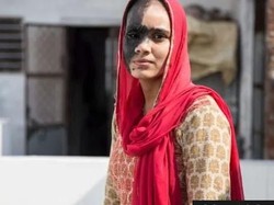 Kisah Sedih Wanita yang Sulit Menikah karena Punya Tanda Lahir di Wajah