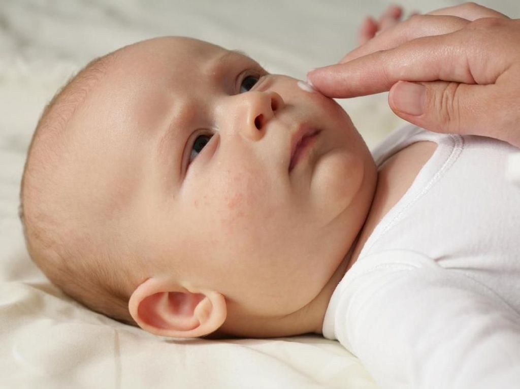 1 Dari 5 Ribu Bayi Terlahir dengan Usus di Luar Perut, Ini Penyebabnya 1 Dari 5 Ribu Bayi Terlahir dengan Usus di Luar Perut, Ini Penyebabnya