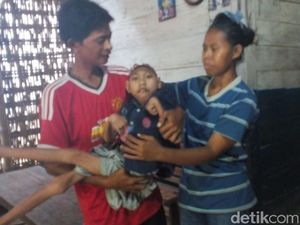 Menengok Remaja Microchepalus di Blora yang Butuh Uluran Tangan