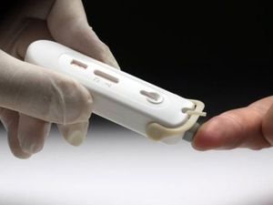 Bos Salon Pemeran Seks Gangbang Positif HIV, Begini Tes HIV Dilakukan