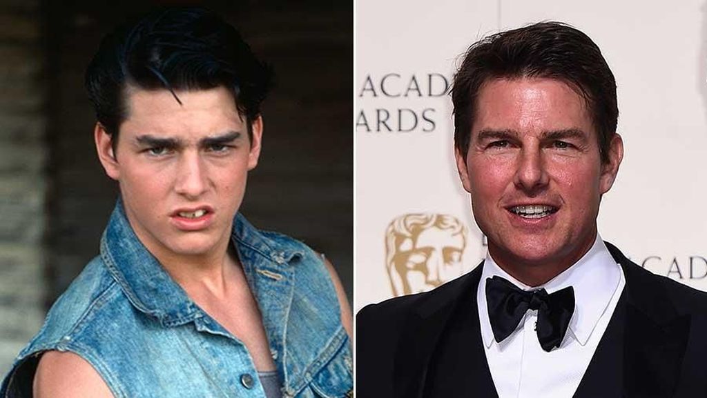 Tom Cruise dan Deretan Selebriti yang Kabarnya Operasi Plastik