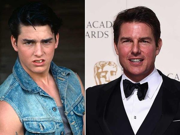 Tom Cruise dan Deretan Selebriti yang Kabarnya Operasi Plastik