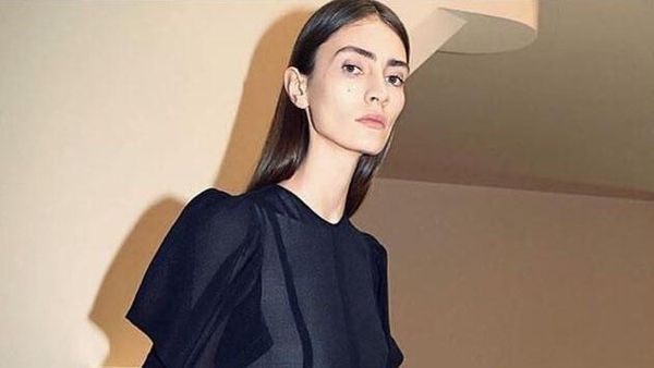 Potret Model Cantik yang Jadi Kontroversi karena Dianggap Terlalu Kurus