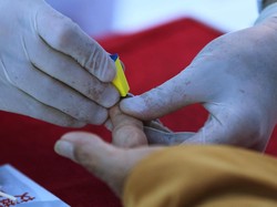 Begini Kiat Sukses Namibia Berantas HIV dan AIDS