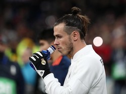 Cedera Bale Tidak Serius, Kok...