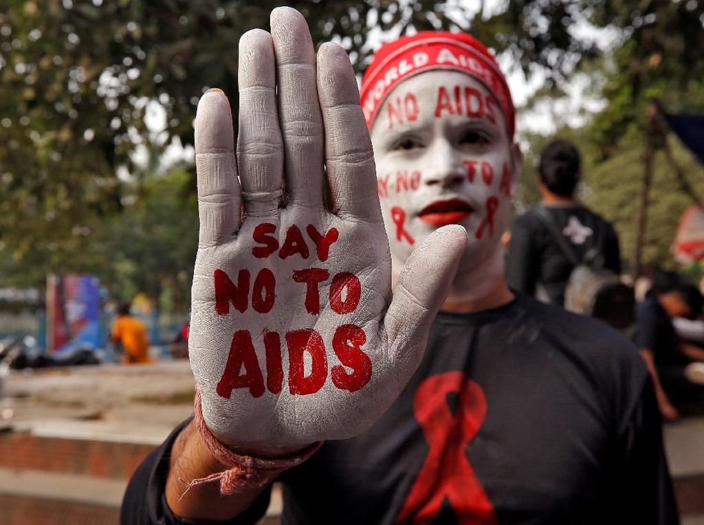 UNAIDS: Penanganan HIV-AIDS di Indonesia Belum Maksimal UNAIDS: Penanganan HIV-AIDS di Indonesia Belum Maksimal
