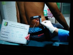 Pulang Kerja, Warga Kediri Dipanah Orang Tak Dikenal