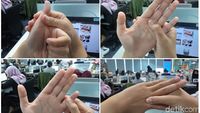 Usir Flu dan Sinus dengan 5 Pijatan Ringan di Tangan Seperti Ini