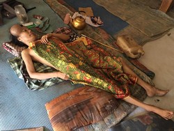 Kisah 2 Bocah Miskin Rawat Ibunya yang Lumpuh Hadapi Tumor Ganas