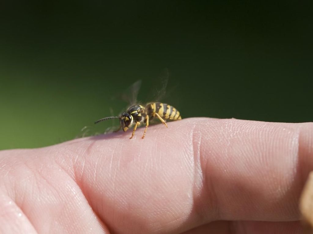 Keluhkan Sakit, Rupanya Lebah Makan Kelenjar Air Mata Wanita Ini
