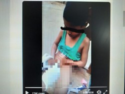 Viral Video Bocah Sunat Sendiri, Netizen Ngilu