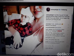 Anaknya Mengidap Plagiocephaly, Ini Pesan Menyentuh Model Chrissy Teigen