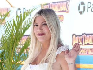 Tori Spelling Curhat Kornea Rusak Kornea gegara 20 Hari Tak Ganti Lensa Kontak