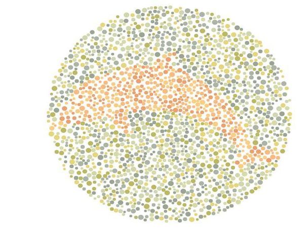 Buta Warna atau Tidak? Tes Mata Kamu Lewat Gambar Berikut