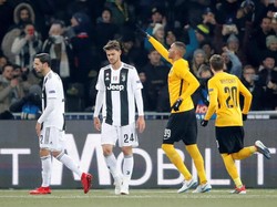 Hasil Liga Champions: Meski Dikalahkan Young Boys, Juve Kunci Juara Grup H