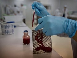 Ngeri! Lab di Amerika Uji Coba Virus COVID Super, Daya Bunuh 80%