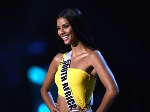 Pemenang Kedua Miss Universe 2018 Tamaryn Green Trauma Pernah Idap TB