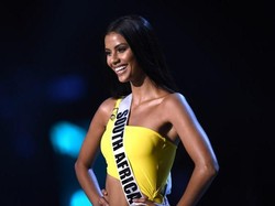 Pemenang Kedua Miss Universe 2018 Tamaryn Green Trauma Pernah Idap TB
