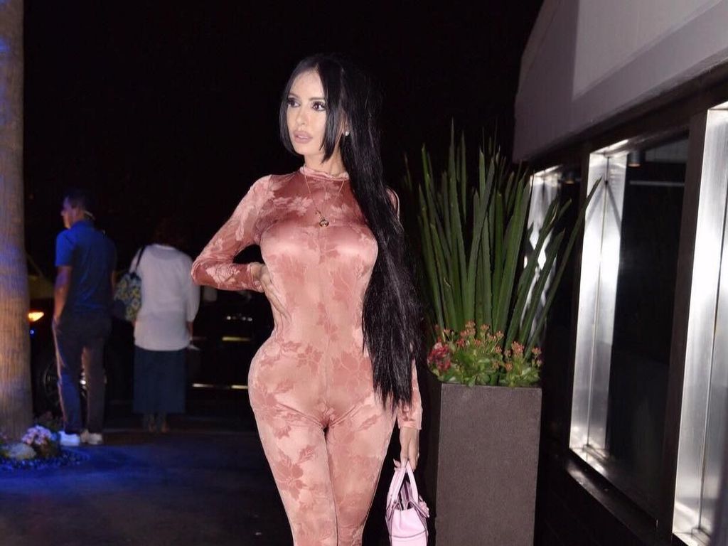 Penyesalan Model yang 500 Kali Botox & Filler Agar Mirip Kim Kardashian Penyesalan Model yang 500 Kali Botox & Filler Agar Mirip Kim Kardashian