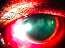 Mata Berbintang Gara-gara Pukulan Keras ke Wajah