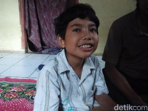 Peluit Masuk Saluran Napas, Asep Dirawat di RSHS Bandung
