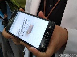 Penampakan Peluit yang Tersedak Bocah Asep