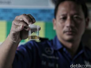 Antara Jijik dan Kagum, Minum Urine Sendiri Demi Kesehatan Antara Jijik dan Kagum, Minum Urine Sendiri Demi Kesehatan