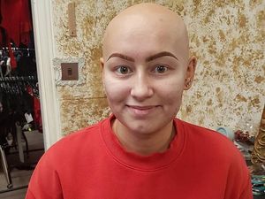 Fotografer Ini Sulap Penderita Botak Akut Jadi Model Lingerie Cantik