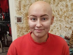 Fotografer Ini Sulap Penderita Botak Akut Jadi Model Lingerie Cantik