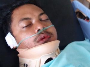 Krisna Adi, yang Dihukum PSSI Seumur Hidup, Kecelakaan dan Koma Krisna Adi, yang Dihukum PSSI Seumur Hidup, Kecelakaan dan Koma