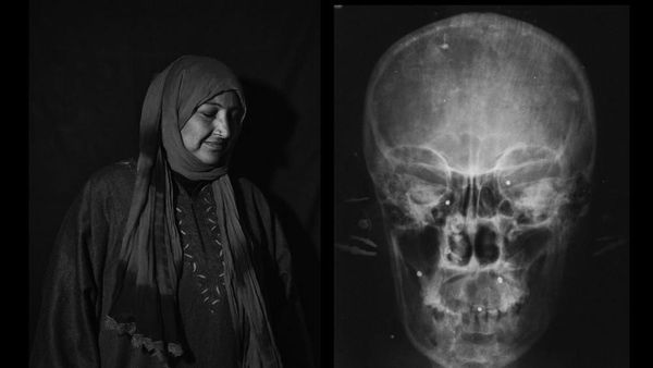 Karya Jawara Kontes Foto Hitam Putih yang Menyentuh