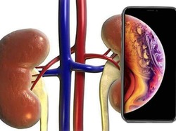 Jual Ginjal Demi iPhone 4, Pria Ini Kini Sakit Parah