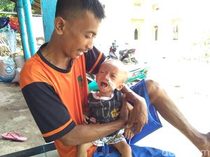Alami Gizi Buruk, Balita di Jepara Ini Butuh Bantuan