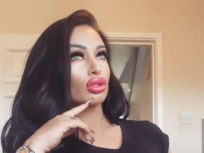 Penampilan Ava, Wanita yang Obsesi Implan Payudara Meski Kulit Hampir Robek