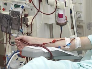 Umur 15 Tahun Sudah Cuci Darah, Kenapa Minuman Manis Bikin Gagal Ginjal? Umur 15 Tahun Sudah Cuci Darah, Kenapa Minuman Manis Bikin Gagal Ginjal?