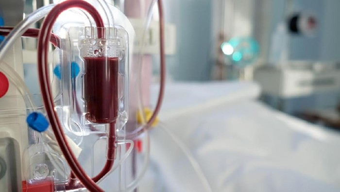 Hemodialisa intensive care emergency room with hemodialysis machine (or hemofiltration procedure) close up tanda penyakit ginjal