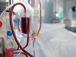 4 Hal Tentang Cuci Darah yang Perlu Bunda Ketahui