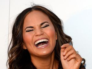 Angioedema, Si Penyakit yang Bikin Bibir Chrissy Teigen Mau Meledak