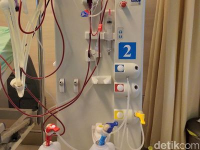 Mengenal Alat Cuci Darah yang Selangnya Sempat Jadi Heboh